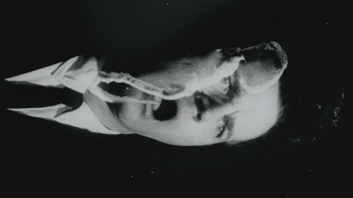 Eraserhead